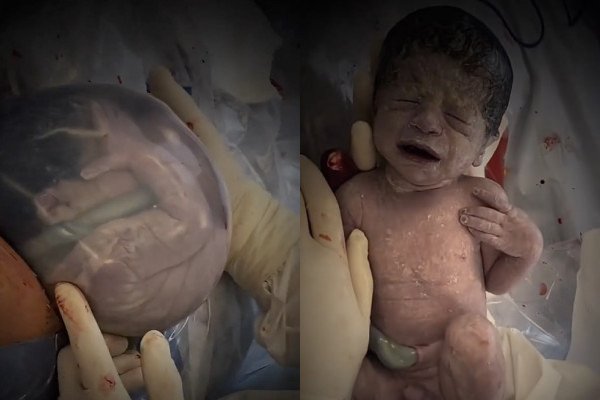 Un bébé filmé dans sa poche de liquide amniotique (Argentine)