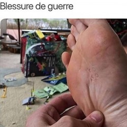 Blessure de guerre